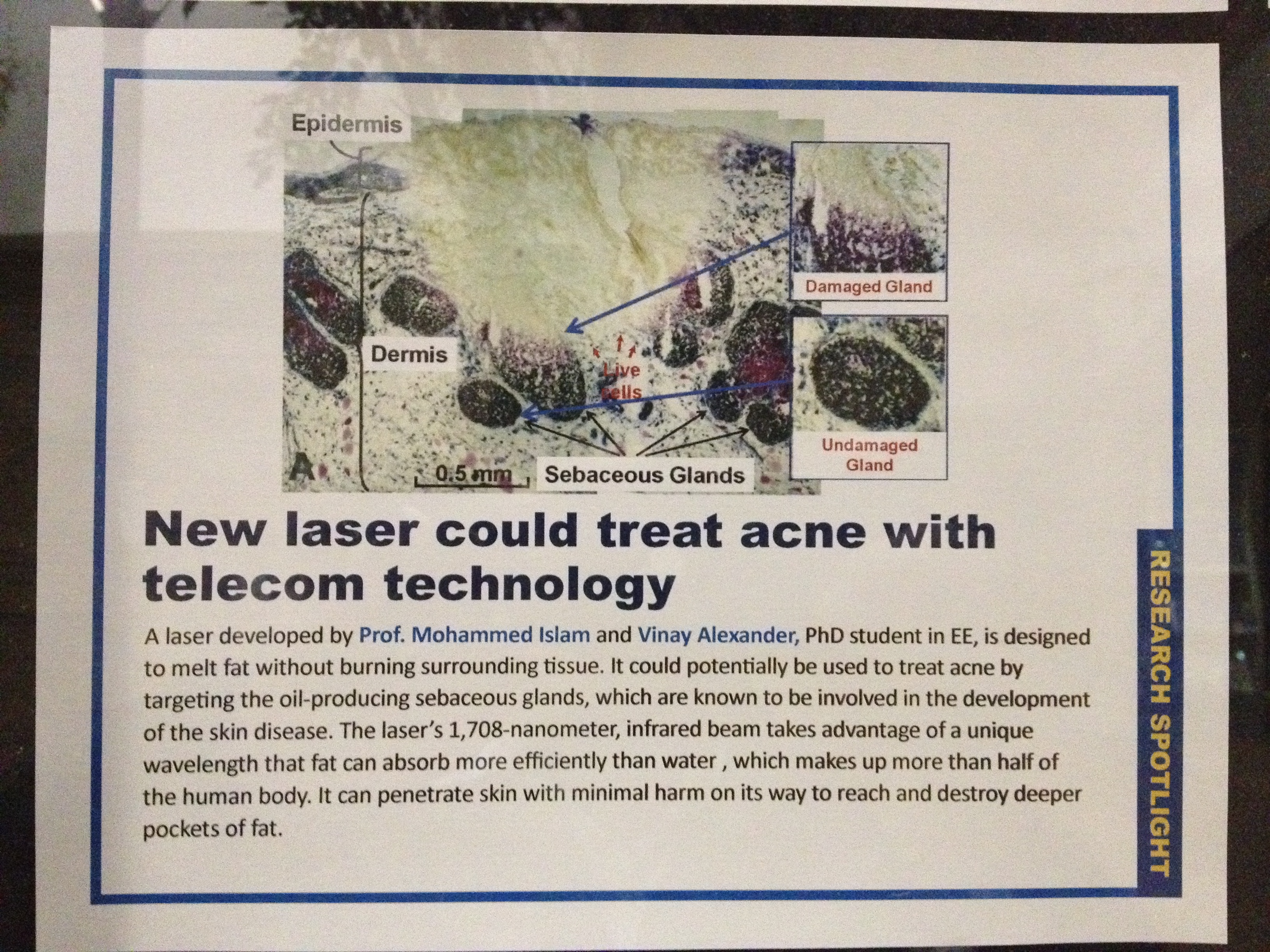 Our 1708 nm Raman Laser